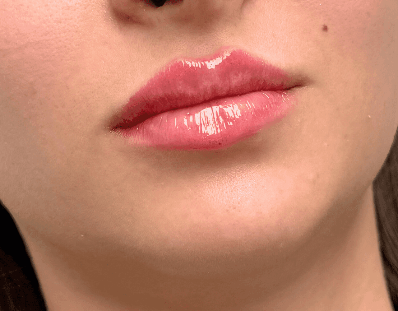 Detailní záběr na rty mladé ženy po ošetření HydraFacial, zvýrazňujícím jejich přirozený tvar.