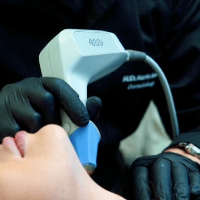 Dermatolog MUDr. Martin Bortlík provádí neinvazivní radiofrekvenční ošetření pleti v oblasti spodní čelisti pomocí přístroje Exilis Elite.